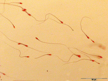 Spermien eines Delfins (Foto: Benjamin Schulz)